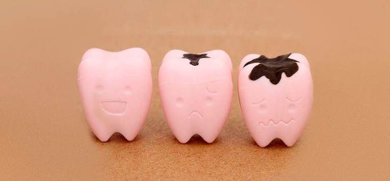 Bệnh về răng